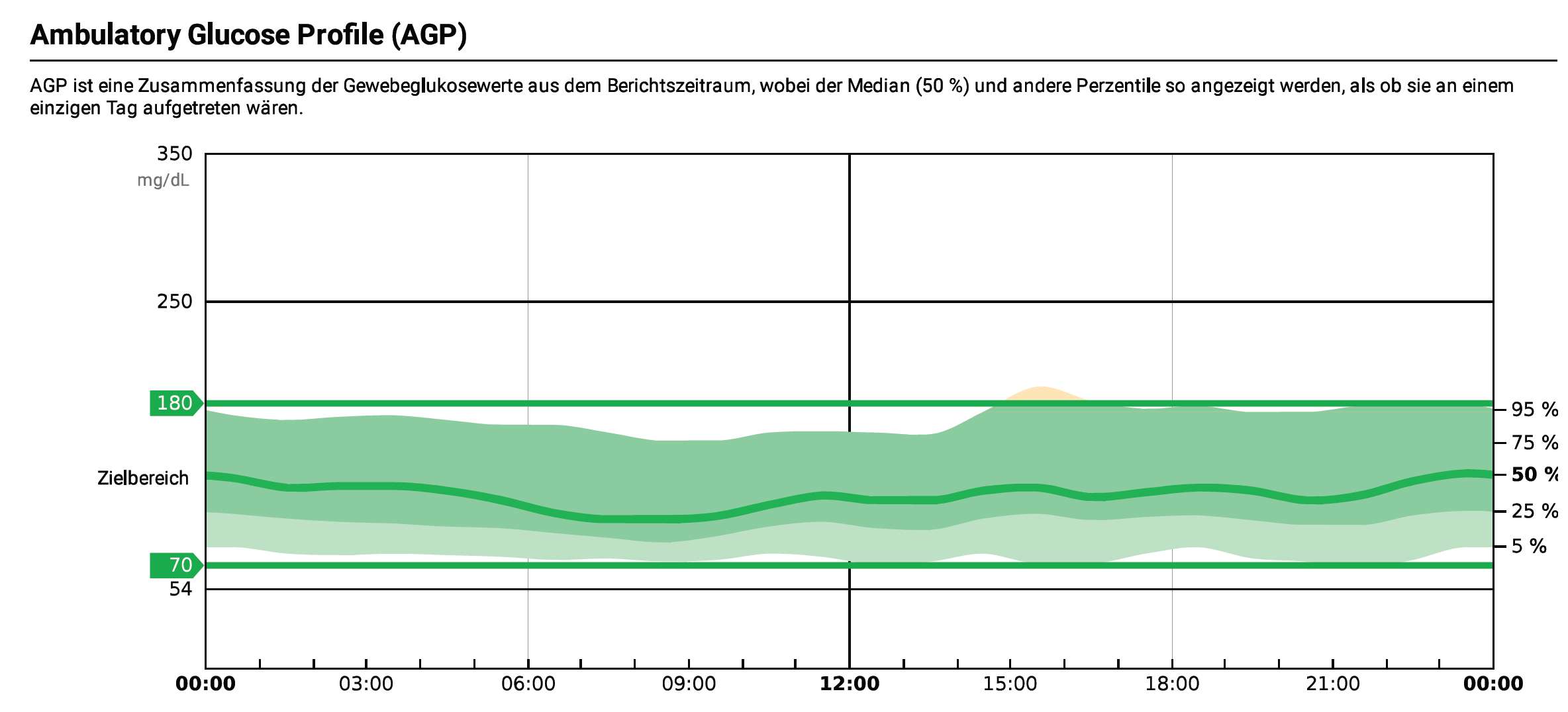 AGP Grafik